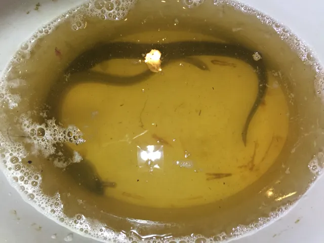 Aal