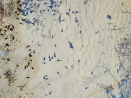 Tunxdorfer Waldsee-2